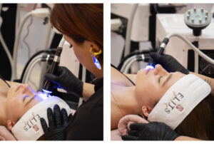 everyou-macchinario-estetico-viso-corpo-03